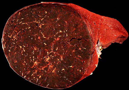 Hamartom Özellikleri ve Faydaları Nelerdir?