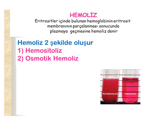 Hemoliz Özellikleri ve Faydaları Nelerdir?