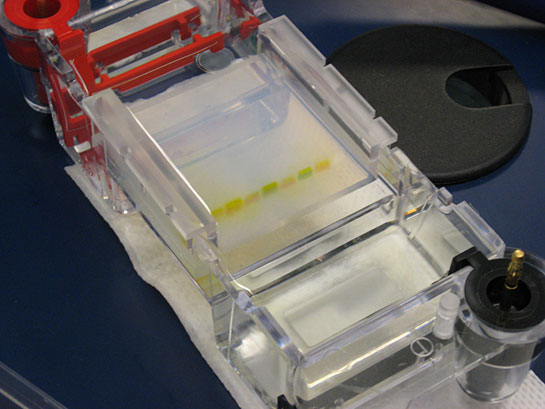 Jel Elektroforezi Özellikleri ve Faydaları Nelerdir?