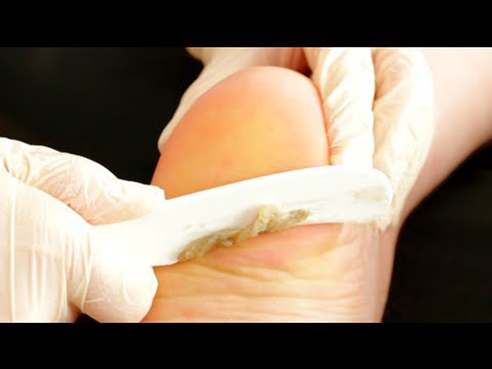 Kallus Özellikleri ve Faydaları Nelerdir?