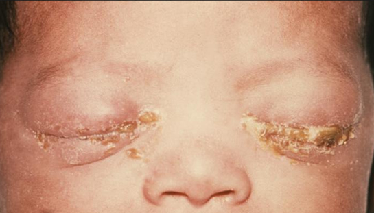 Klamidya Özellikleri ve Faydaları Nelerdir?