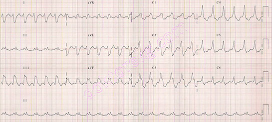 Konkordans Özellikleri ve Faydaları Nelerdir?