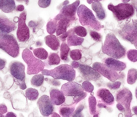 Mikoplazma Özellikleri ve Faydaları Nelerdir?