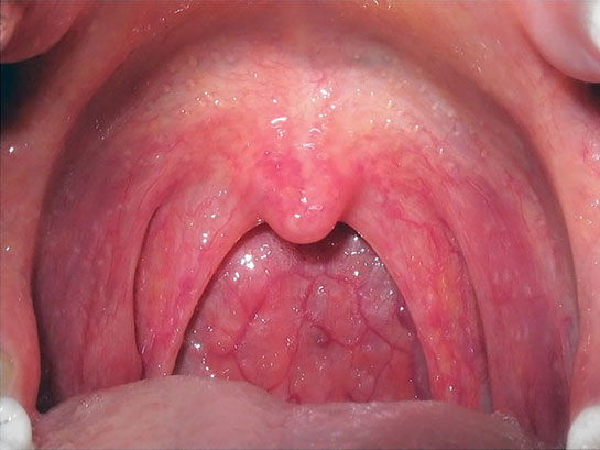 Mukoza Özellikleri ve Faydaları Nelerdir?