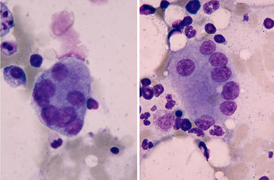 Osteoklast Özellikleri ve Faydaları Nelerdir?