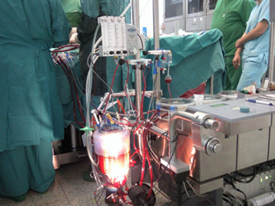 Perfüzyon Özellikleri ve Faydaları Nelerdir?