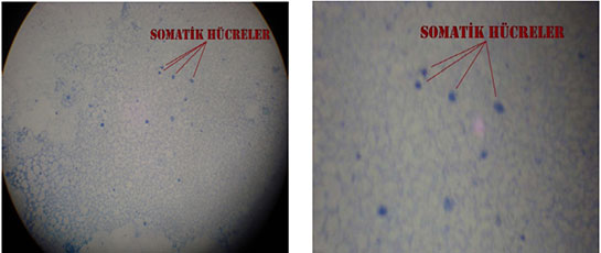 Somatik Hücre Özellikleri ve Faydaları Nelerdir?