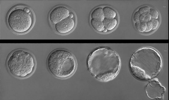 Zigot Özellikleri ve Faydaları Nelerdir?